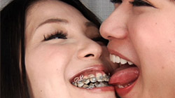 Tooth fetish lesbian kiss 04